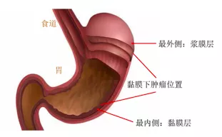圖文圖片