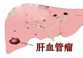 圖文圖片