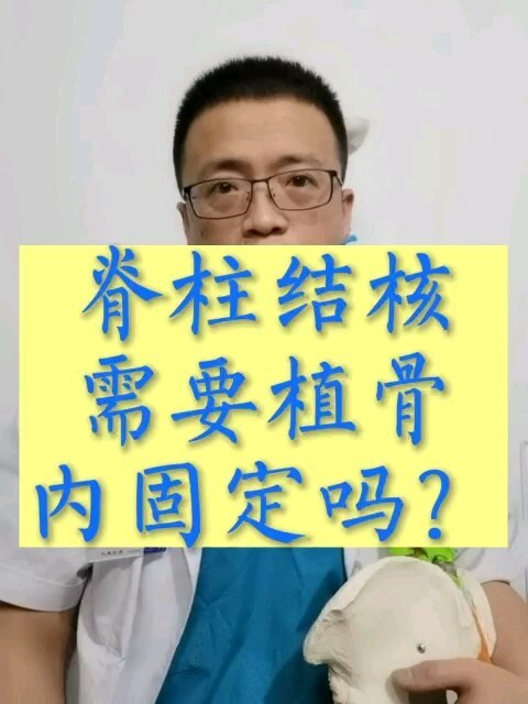 脊柱结核需要植骨内固定吗？