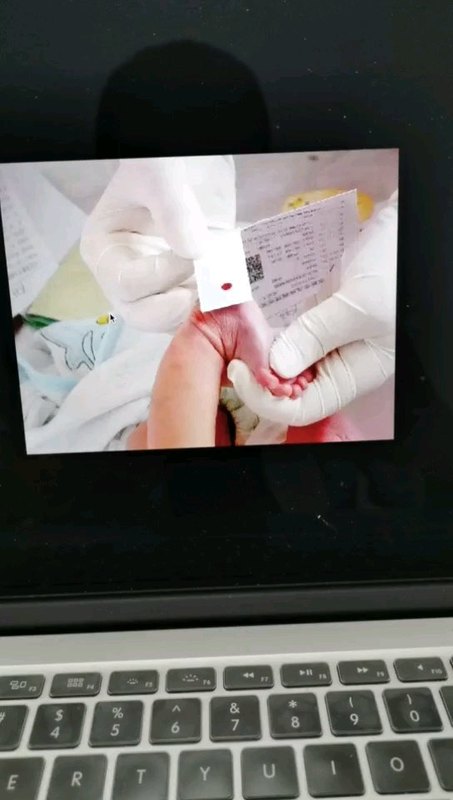 详解新生儿足跟血采集---为什么要采足跟血不扎别的地方