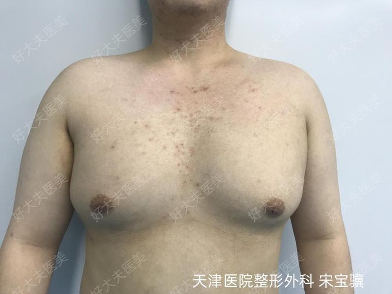 圖文圖片